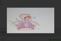 Perhatikan gambar di atas ini! Bagian yang ditunjuk huruf F berfungsi sebagai sekat rongga badan adalah ….