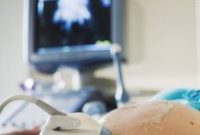 Mengapa Kontrol Kehamilan Rutin Itu Penting